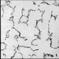 interdendritic graphite in hypoeutectic 
        gray iron, 100x