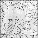 disheveled graphite flakes in hypereutectic 
       gray iron, 100x