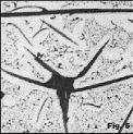 coarse needlelike graphite in hypereutectic 
        gray iron, 100x